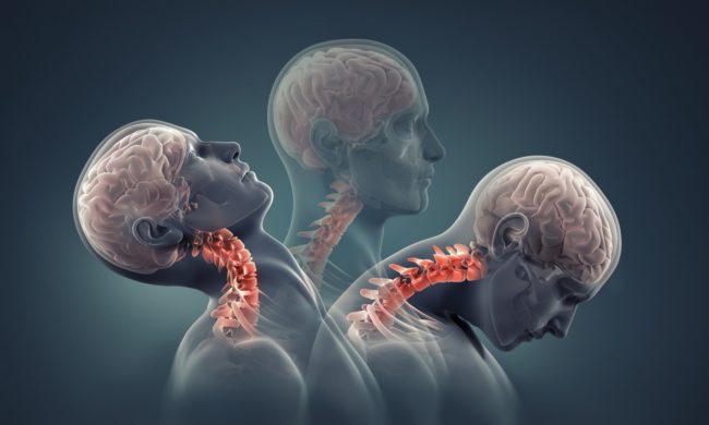 Chiropractic for Car Accidents
